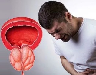 The symptoms of chronic prostatitis in men
