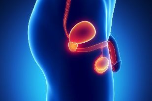 Inflammation of the prostate